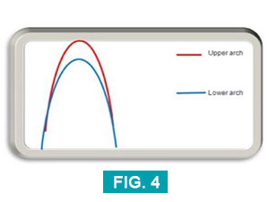 a narrow arch is an unhealthy bite